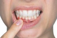 susana gutierrez clinica dental tratamientos perio